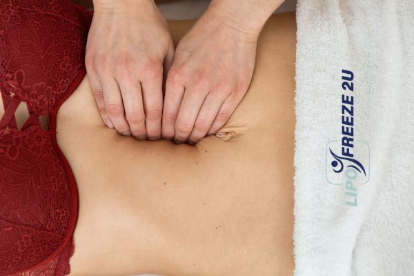 diastasis recti treatment Newmarket