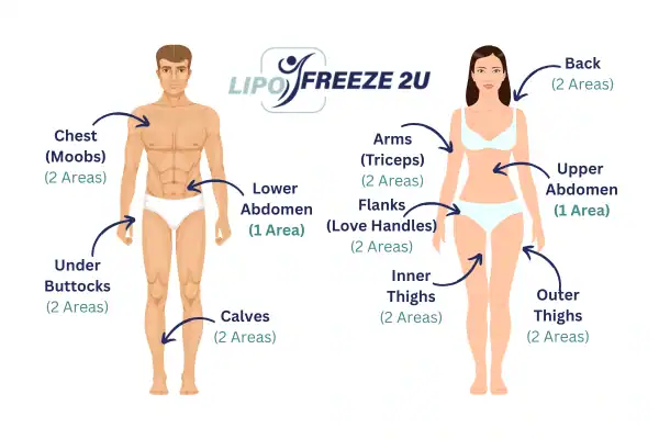 Areas you can have fat freezing treatment Newmarket