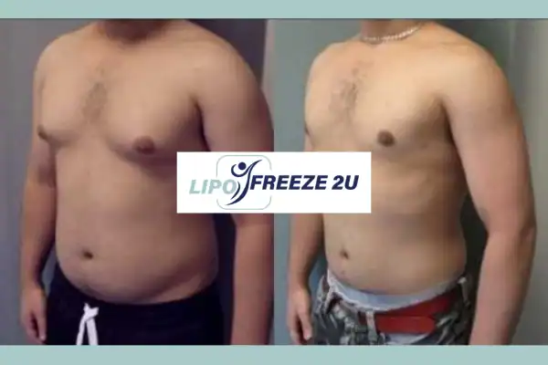 How Long Does It Take to See Results Newmarket?