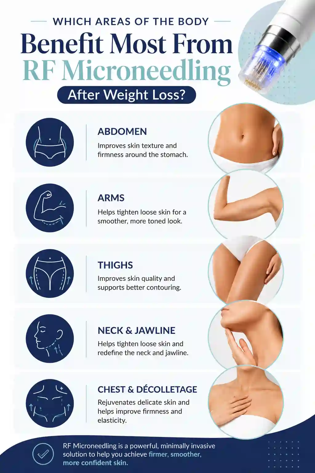Which Areas of the Body Benefit Most From RF Microneedling After Weight Loss Newmarket